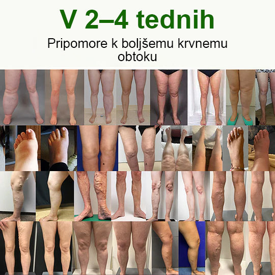 🌿Poslovite se od otečenih, bolečih nog – Mickey® FluidEase Profesionalna krema za izboljšanje prekrvavitve nog prinaša pravo olajšanje!