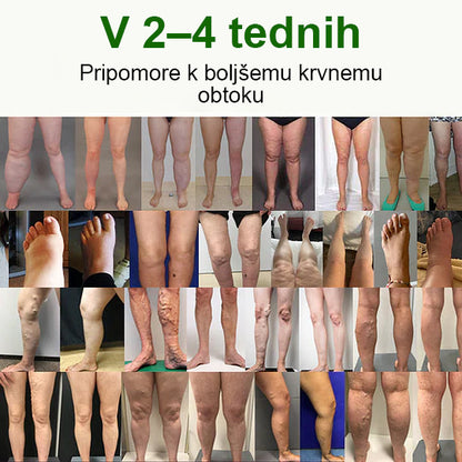 🌿Poslovite se od otečenih, bolečih nog – Mickey® FluidEase Profesionalna krema za izboljšanje prekrvavitve nog prinaša pravo olajšanje!