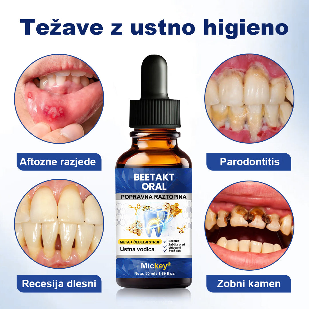 ✨Mickey® BeeTakt Szájápoló Javító Oldat
