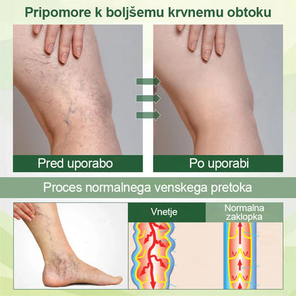 🌿Poslovite se od otečenih, bolečih nog – Mickey® FluidEase Profesionalna krema za izboljšanje prekrvavitve nog prinaša pravo olajšanje!