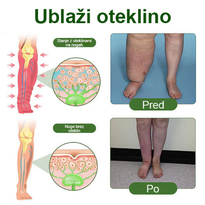 🌿Poslovite se od otečenih, bolečih nog – Mickey® FluidEase Profesionalna krema za izboljšanje prekrvavitve nog prinaša pravo olajšanje!