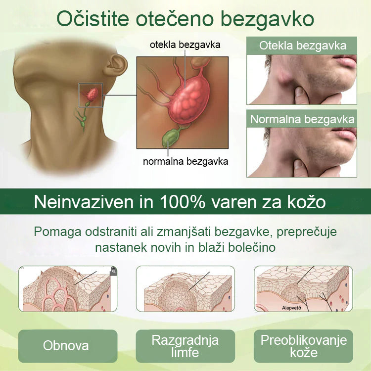 🌿Poslovite se od otečenih, bolečih nog – Mickey® FluidEase Profesionalna krema za izboljšanje prekrvavitve nog prinaša pravo olajšanje!