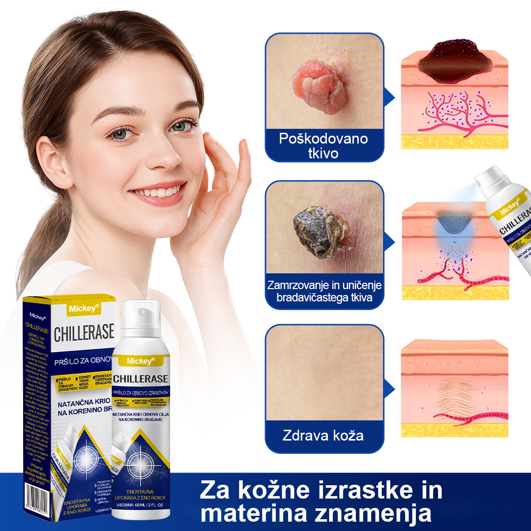 💎Mickey® ChillErase Sprej za pomlajevanje izboklin
