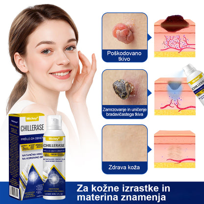 💎Mickey® ChillErase Sprej za pomlajevanje izboklin