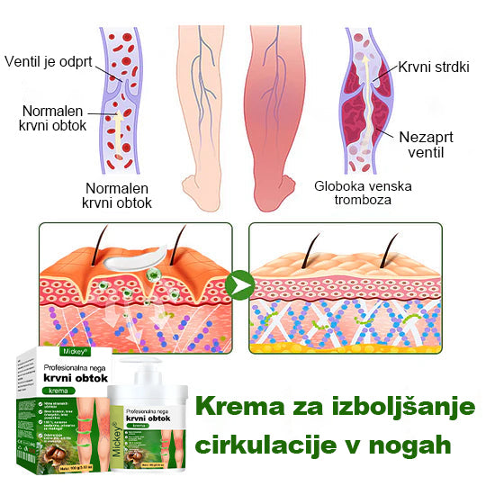 🌿Poslovite se od otečenih, bolečih nog – Mickey® FluidEase Profesionalna krema za izboljšanje prekrvavitve nog prinaša pravo olajšanje!